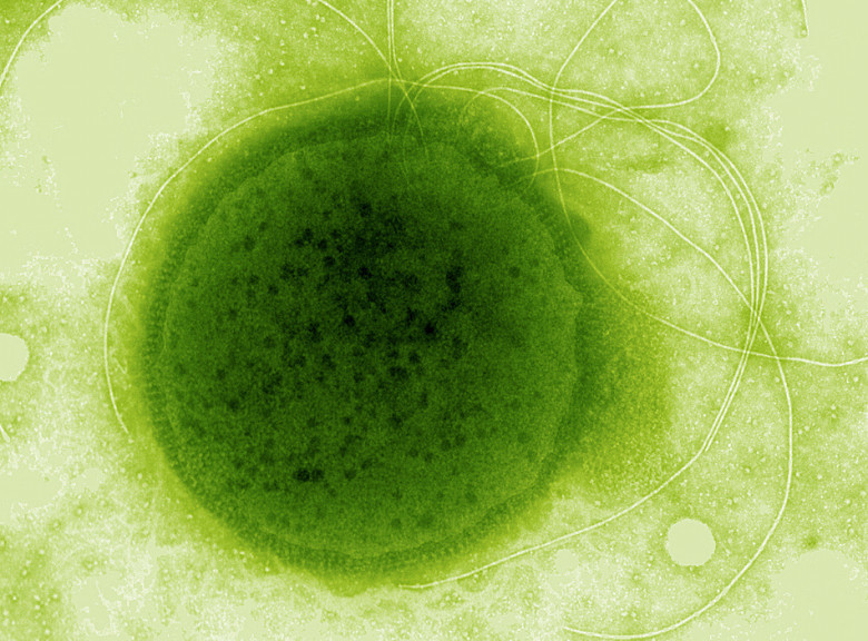Археи / Thermococcus gammatolerans