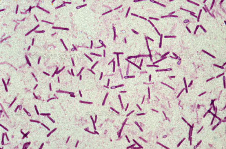 1. Clostridium botulinum.