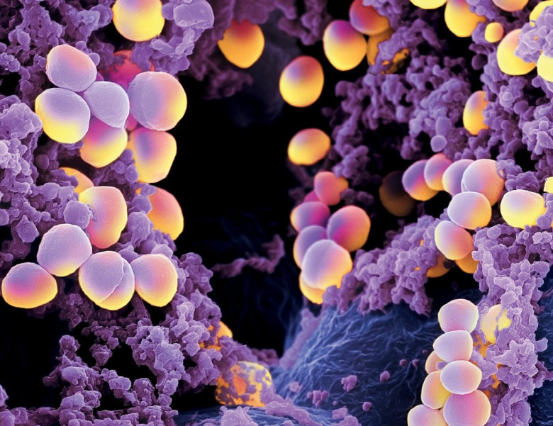 7. Staphylococcus