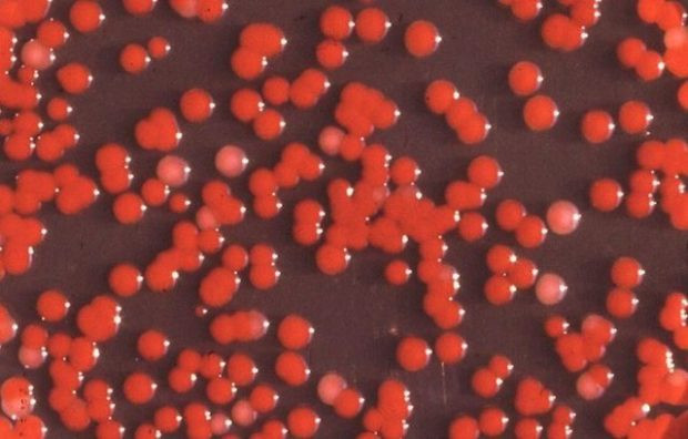 Соединённые Штаты распылили бактерии Serratia Marcescens над несколькими крупными городами