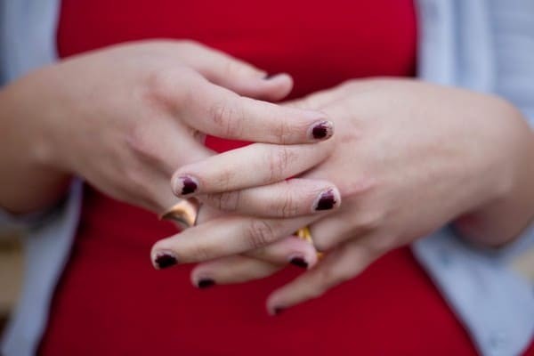 4. Потрескавшийся лак на ногтях