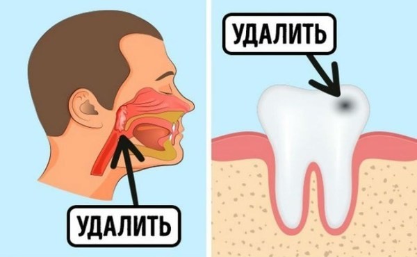 7. Теория очаговых инфекций