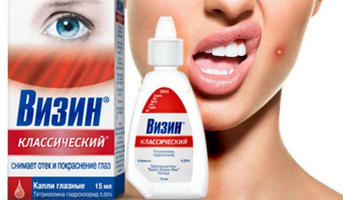 5. Глазные капли против прыщей