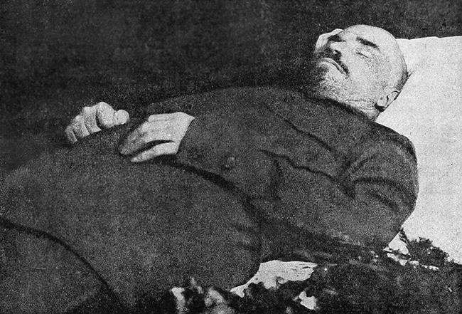 Суета вокруг тела