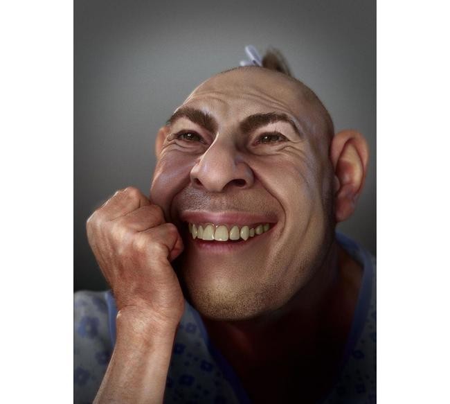 Шлитци