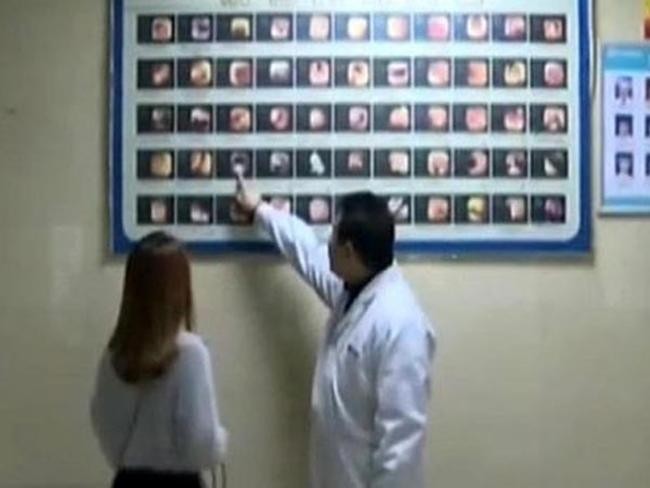 Грибы длиной в 7 сантиметров, растущие в кишечнике