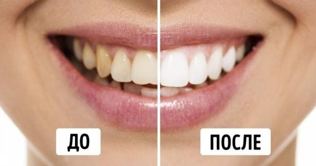 4. Улыбка на миллион