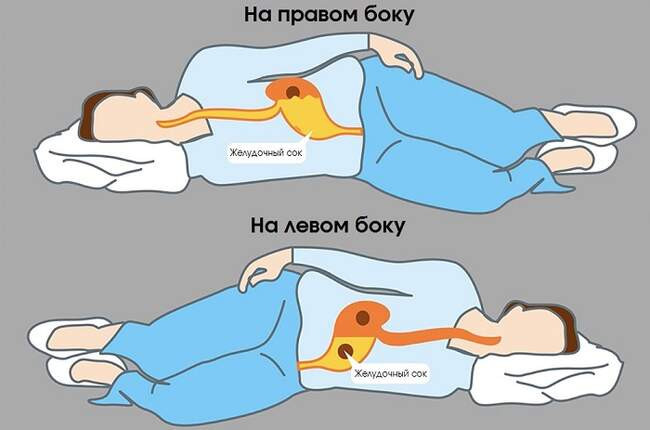 Совет 1: Спите на левом боку