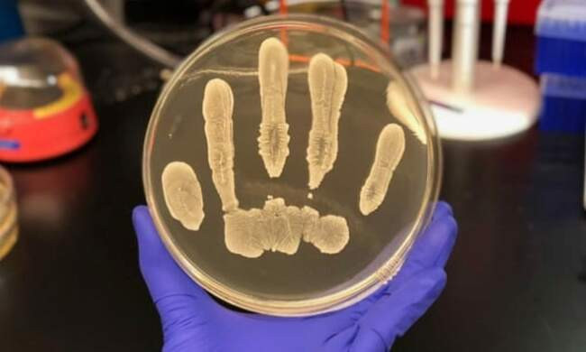 1. Эпидермальный стафилококк Staphylococcus Epidermidis, борец с раком