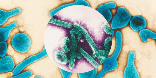 5 Геморрагическая лихорадка Марбург (Marburgvirus)