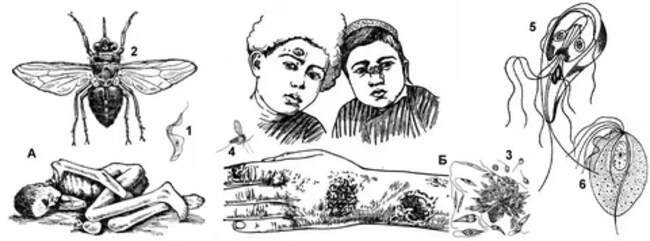 Лейшманиоз
