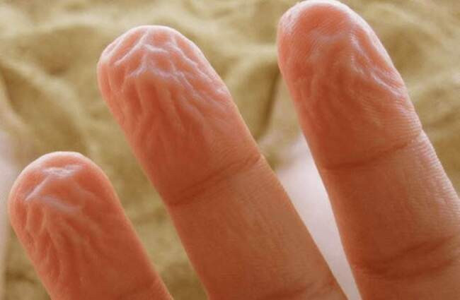 2. Пальцы, которые распухают в воде