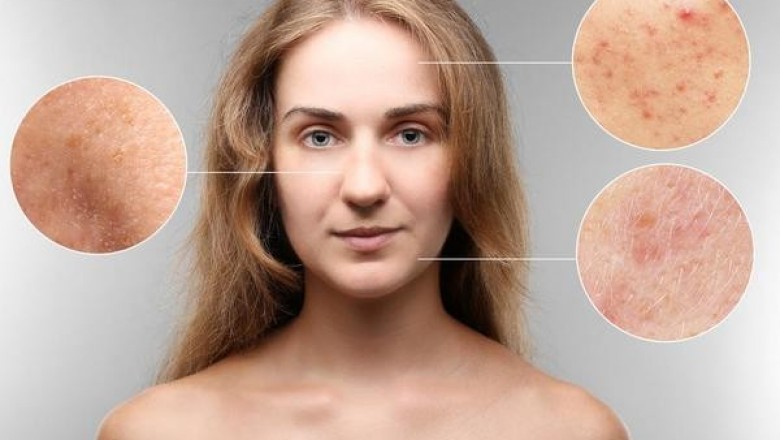 Малоизвестные заболевания кожи, о которых вы могли и не слышать