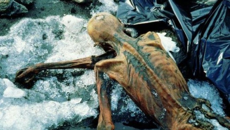 Ученые предполагают, что татуировки на теле Эци (ледяного человека) это примитивная форма иглоукалывания