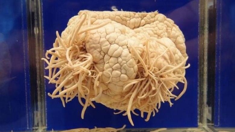 Meguro Parasitological Museum: японцы собрали 300 мерзких экспонатов в токийском музее паразитологии, от которых мурашки по коже