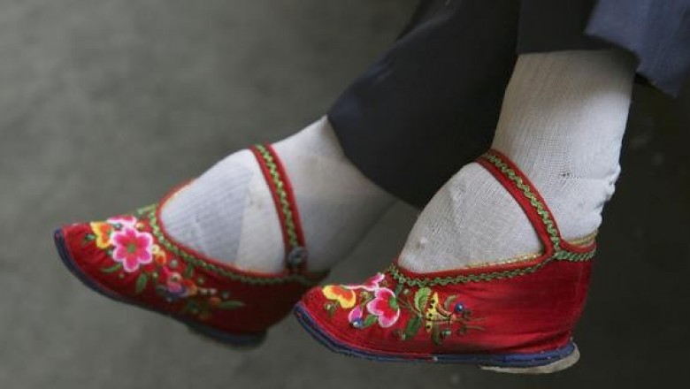 Сломанные пальцы, инфекции и невыносимая боль: как женщины в Китае бинтовали ножки, чтобы сделать их привлекательнее