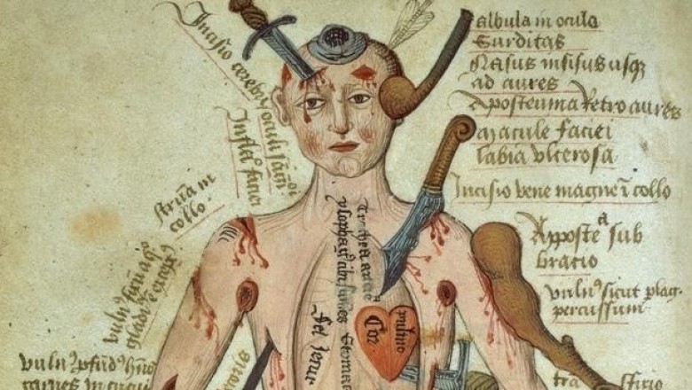 От Гиппократа до Пирогова и Листера: краткая история военно-полевой хирургии
