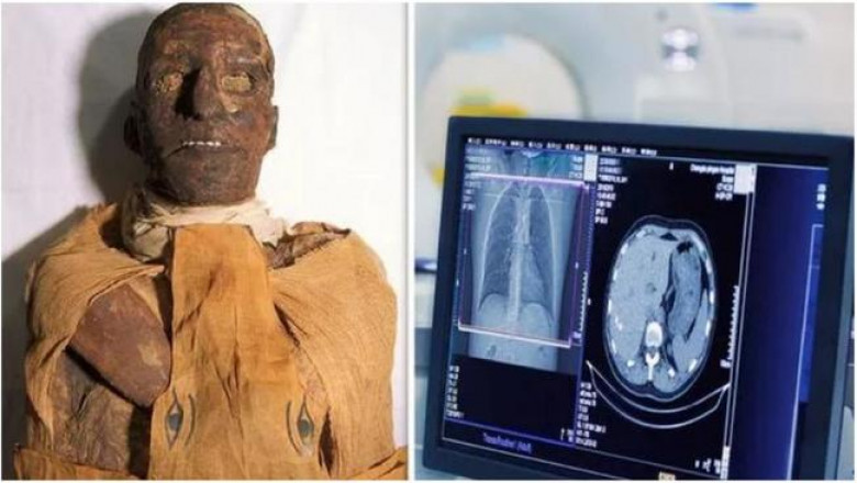 Сканирование тела 3000-летнего фараона Рамзеса III раскрыло загадку его гибели