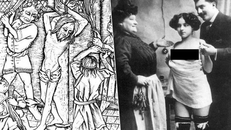 Пиявки, порка и ртуть: как в прошлом лечили венерические заболевания