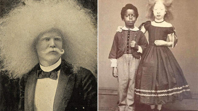 Альбиносы XIX века, попавшие в объектив фотографа