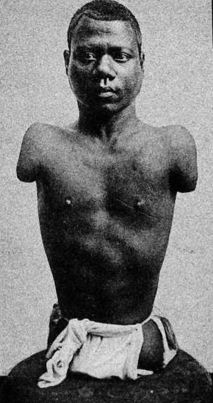 Начало пути: ребёнок, бросивший вызов судьбе