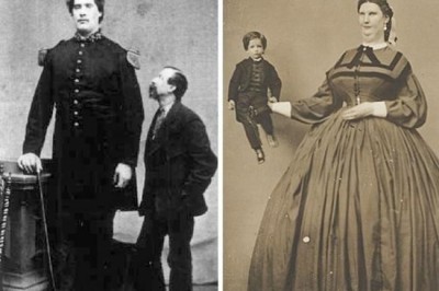 Реальные люди-мутанты, которые могли бы стать героями современных фильмов-ужасов