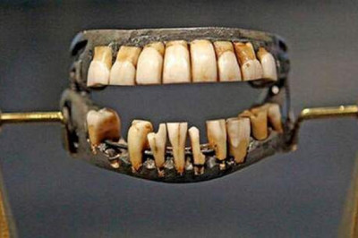 «Зубы Ватерлоо»: французская челюсть в английском рту